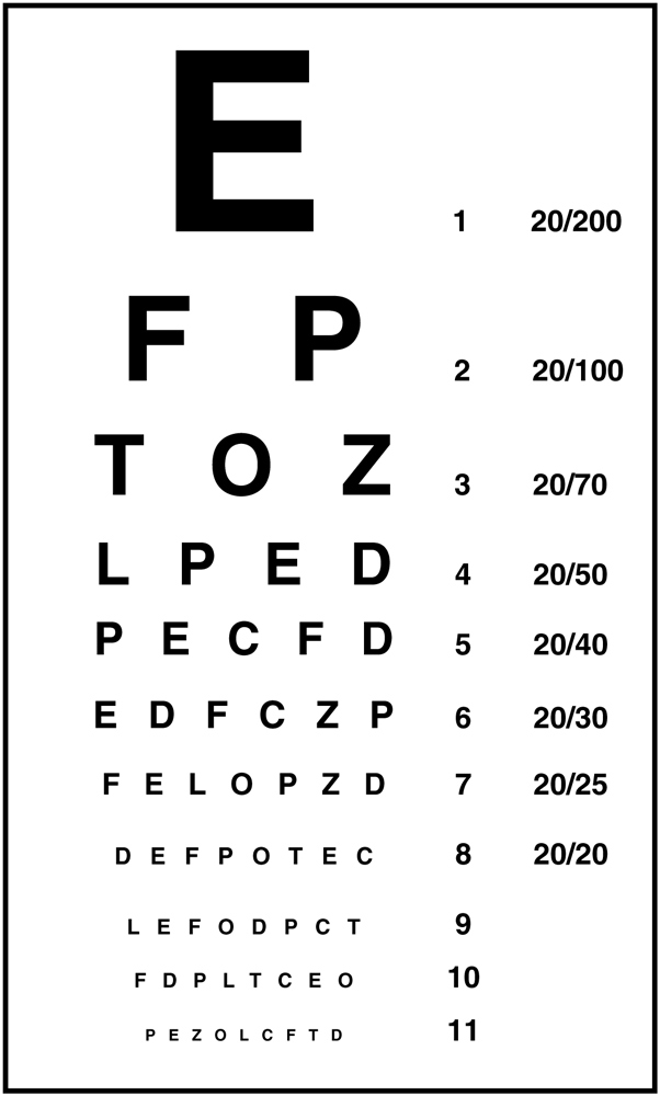 Machine Vision Cognex